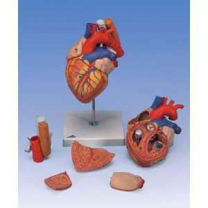  5 Part Heart with Oesophagus and Trachea 2 Times Life Size 