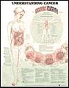 Understanding Cancer Anatomical Chart, (1587797615), Lippincott 
