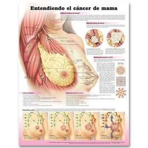  Understanding Breast Cancer Spanish Chart/Poster 