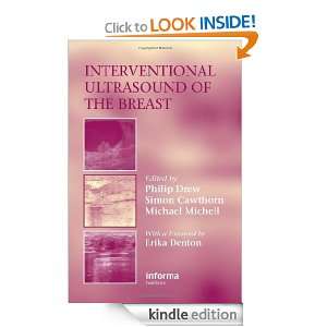 Interventional Ultrasound of the Breast Philip Drew, Simon Cawthorne 