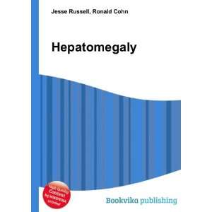  Hepatomegaly: Ronald Cohn Jesse Russell: Books