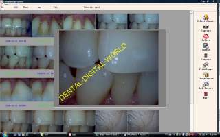 NEW IntraOral Oral DENTAL CAMERA Imaging Work/w Dexis,Dentrix 