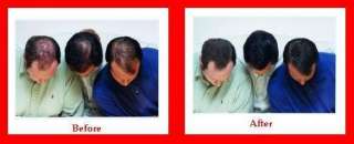 HairSoReal HSR  hair styles  Hair loss, hair solution  